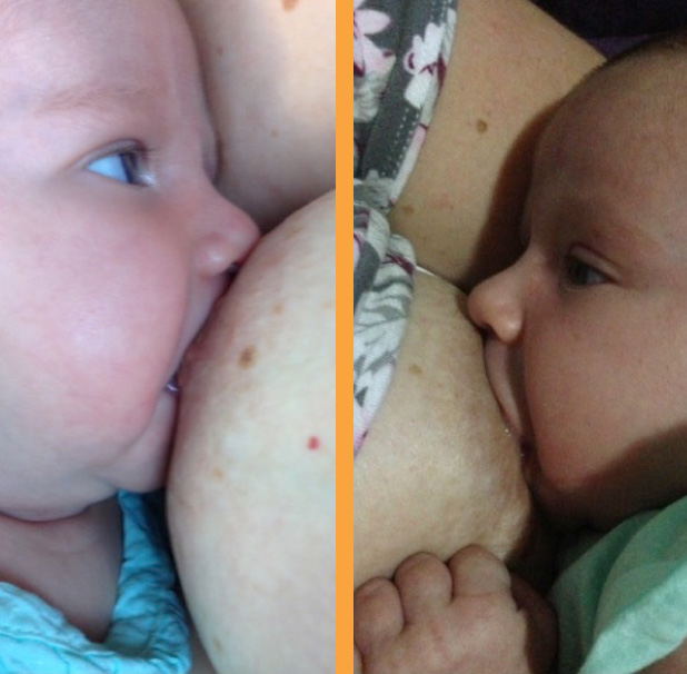 Breastfeeding
